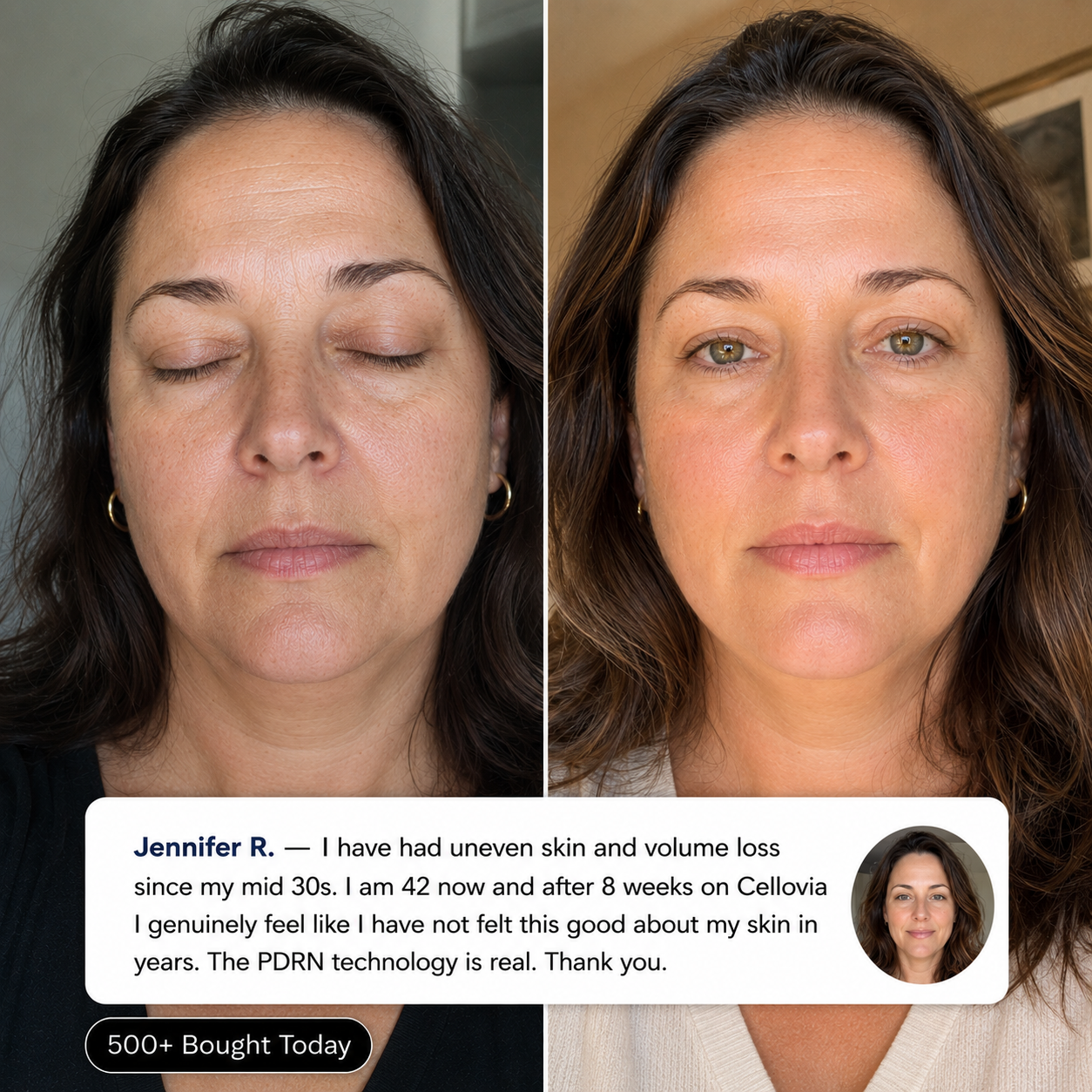 Before and after using PDRN Pink Collagen Stick demonstrating improved skin plumpness and firmness.