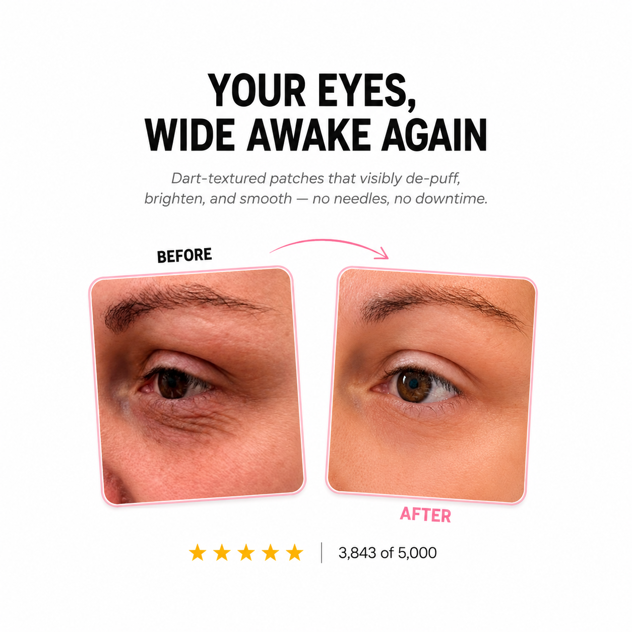 Microneedle Eye Patches-  Retinol + Plant Squalane