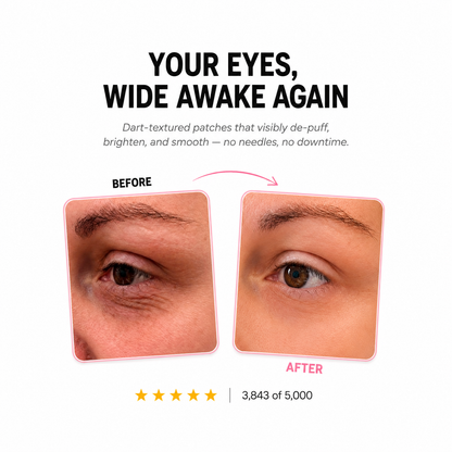 Microneedle Eye Patches-  Retinol + Plant Squalane