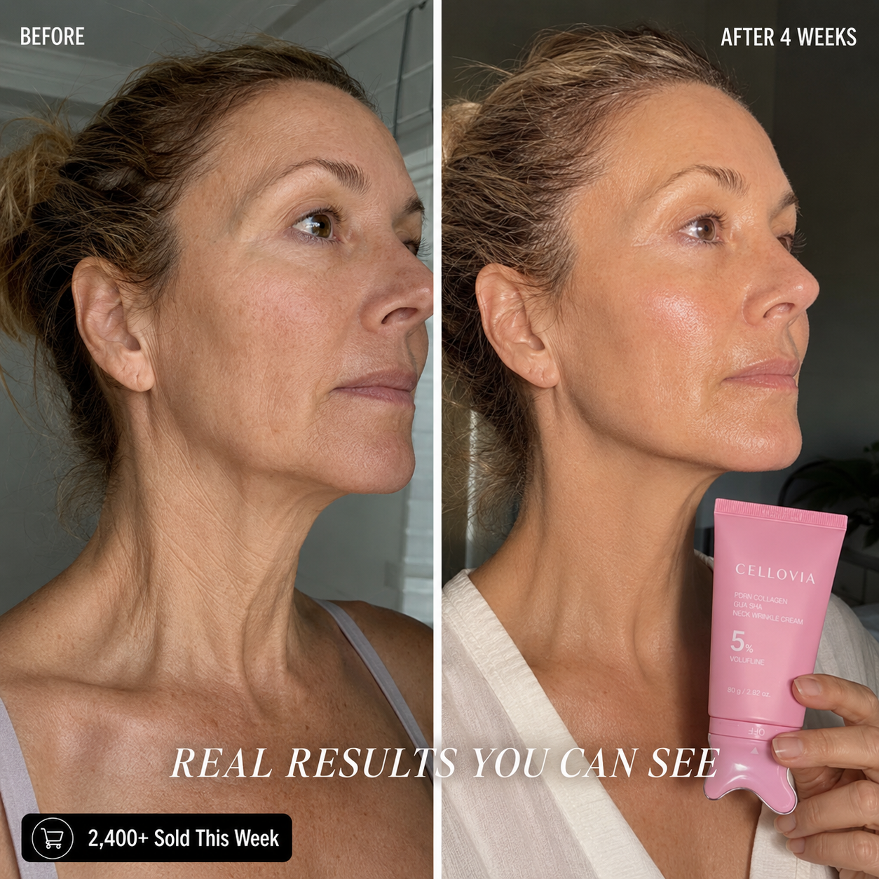 Before and after results using PDRN Collagen Gua Sha Cream after 4 weeks of use, showcasing skin firming effects.