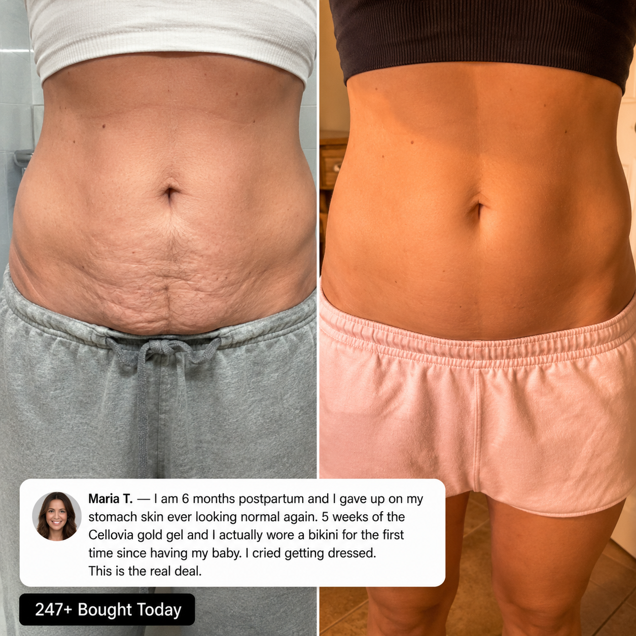 Before and after image of postpartum belly transformation using Cryo Thermo Firming Gold Gel.