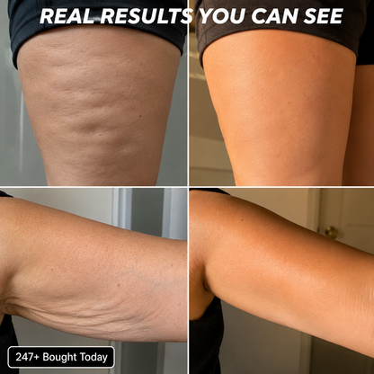 Real results showing skin improvement after using Cryo Thermo Firming Gold Gel for body firming.
