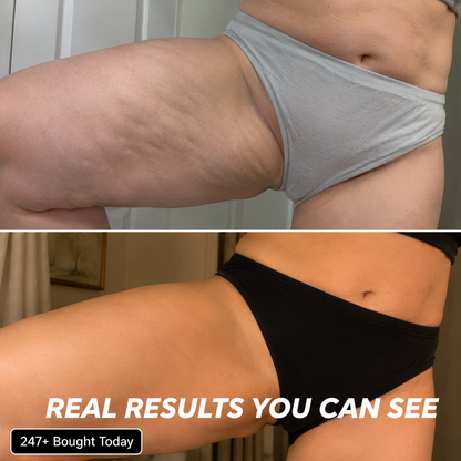 Before and after results showing the effectiveness of Cryo Thermo Firming Gold Gel on skin firmness.