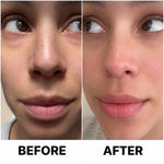 Cellovia microneedle eye patch before and after comparison showing reduced under-eye puffiness and fine lines.